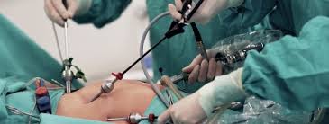 metoda laparoskopowa